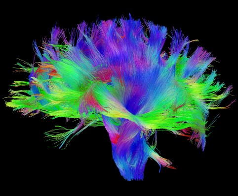 Diffusion MRI of the human brain.  Source: Human Connectome Project.