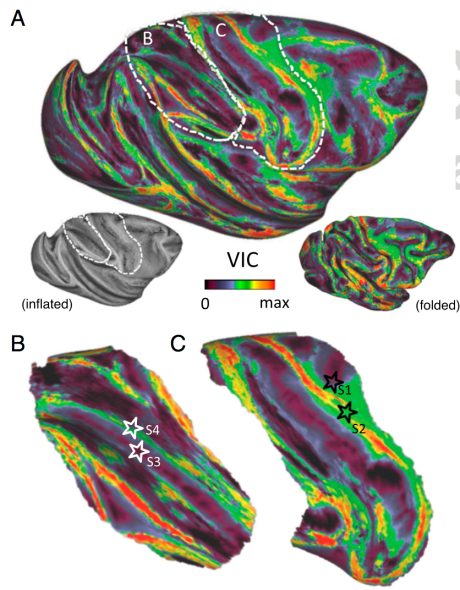 This image shows, on a colour scale, the 'reachability' of different parts of the brain by diffusion tractography.
